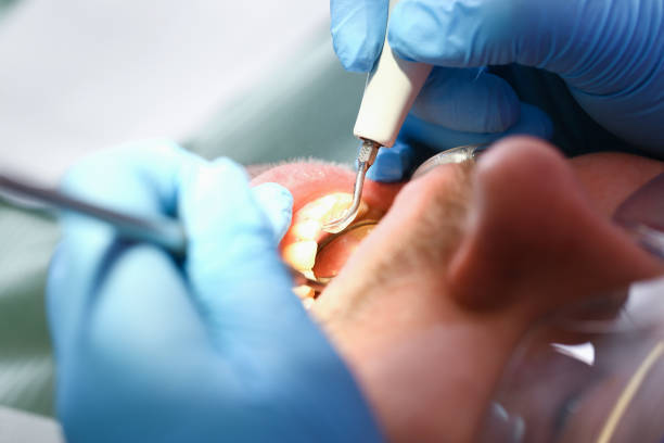 Best Chipped Tooth Repair Near Me  in Nashville, GA