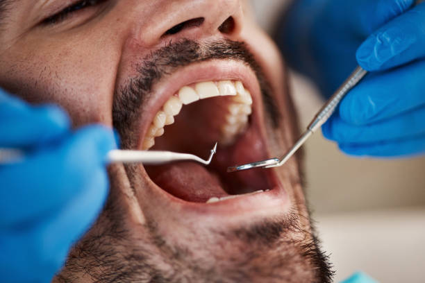  Nashville, GA Emergency Dentist Pros